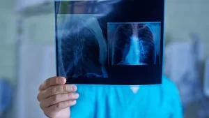 f52e24dbe79fca7ddf9f854fecf02d03