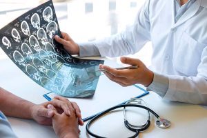 esclerosis múltiple