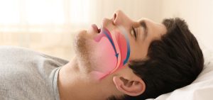 apnea-del-sueno-centro-nacional-de-bruxismo-1200x565-1