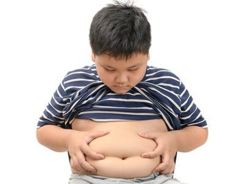 obesidad y niños