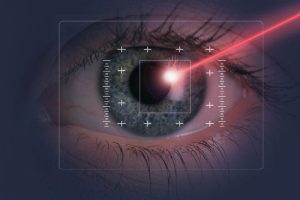 glaucoma laser ojo