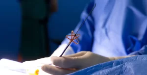 cardiologia-cateter-ablacion-cardiaca-energia-campo-pulsado-arritmias