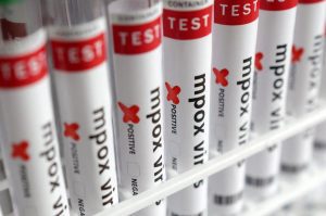 mpox viruela símica