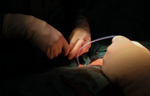 Cirugía Cambio de Género