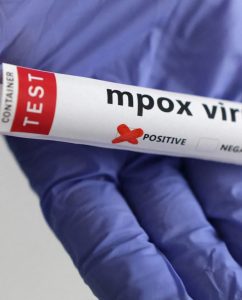 Mpox viruela símica del mono