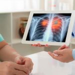 PharmaMar cáncer de pulmón