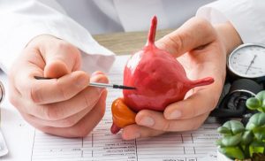 El cáncer de vejiga