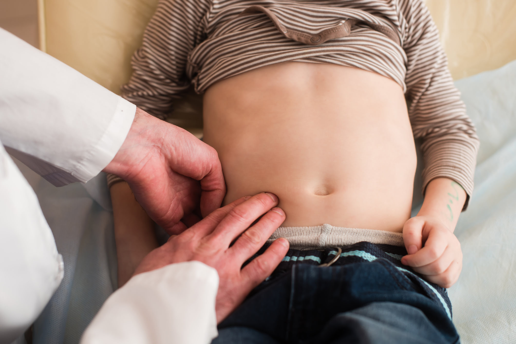 Enfermedad de Crohn