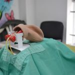 Vasectomía sin Bisturí