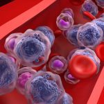 cáncer de la sangre