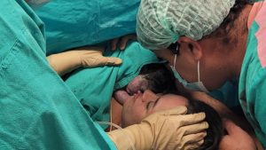 primera bebé operada dentro del útero