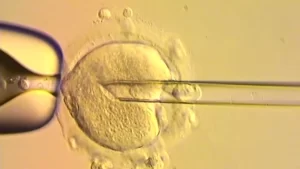 IVF technique