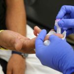 La hepatitis D es cancerígena