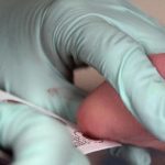 La pesquisa neonatal