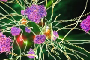 litio cerebro alzheimer