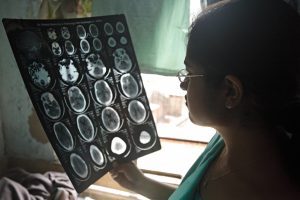 Afecciones neurológicas