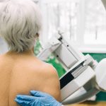 Cáncer de mama después de los 70