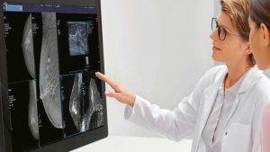 La reconstrucción mamaria