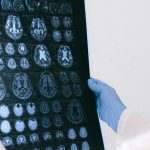 Biomarcadores relevantes