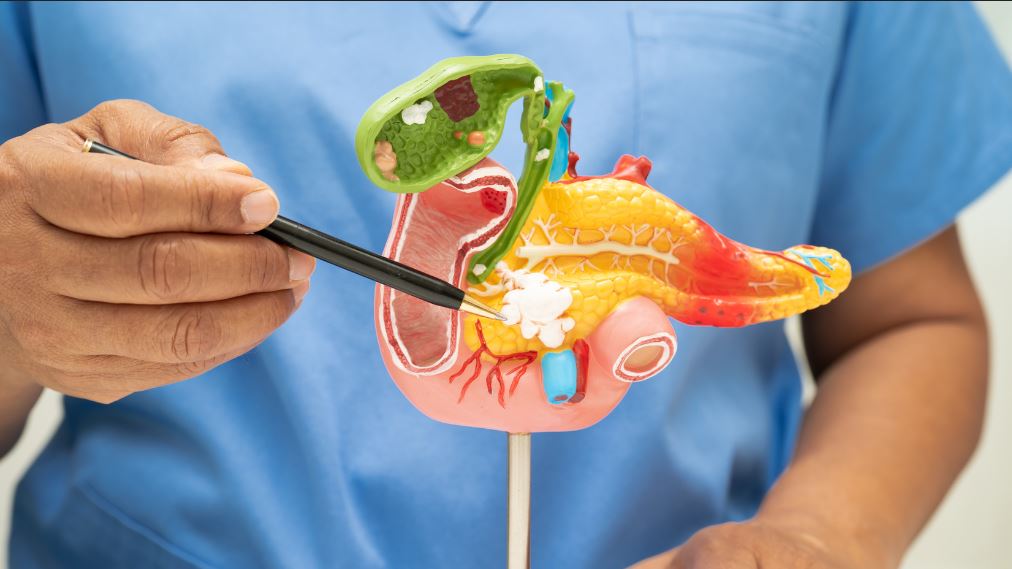 Cáncer de vías biliares