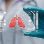 El cáncer de pulmón