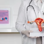 cáncer de cuello uterinos