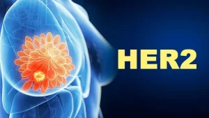 cancer de mama_her2_800x450