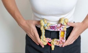 sintomas-enfermedad-crohn