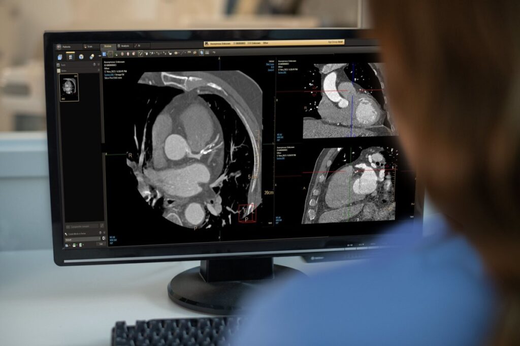 escaneo corazon pantalla