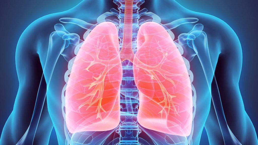 Hipertensión Arterial Pulmonar