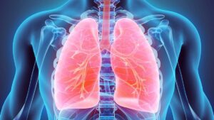 Hipertensión Arterial Pulmonar