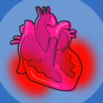 corazon inflamacion