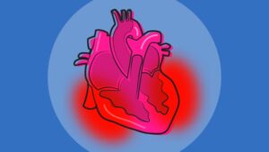 corazon inflamacion
