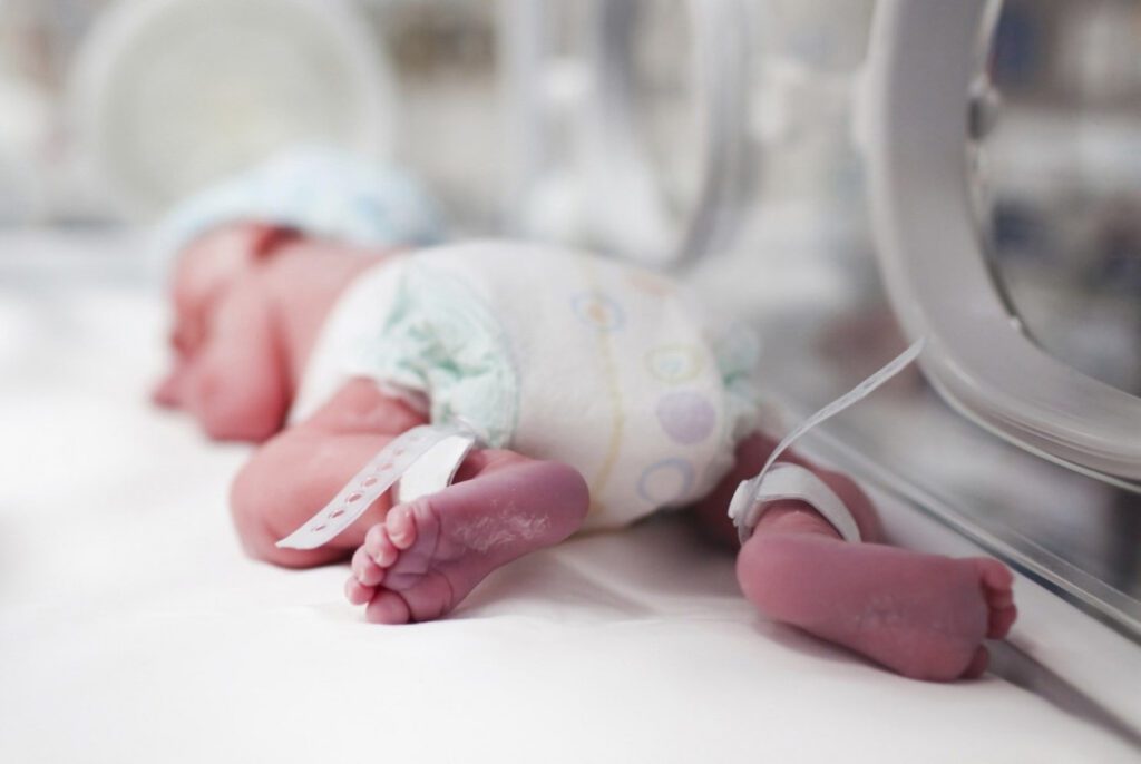 neonatologia bebe incubadora