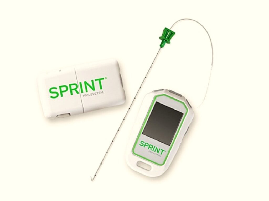 spr therapeutics sprint dolor crónico