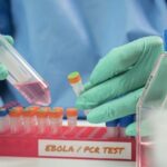 ebola test