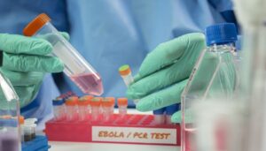 ebola test
