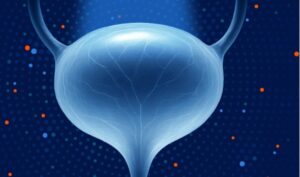 cg oncology.