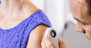 melanoma avanzado