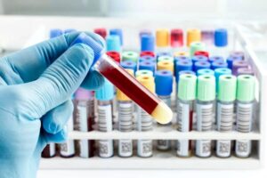 test sanguineo sangre