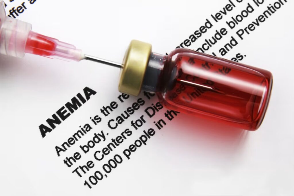 inyecciones de hierro anemia