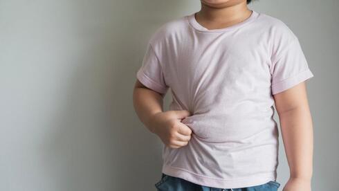 obesidad niños