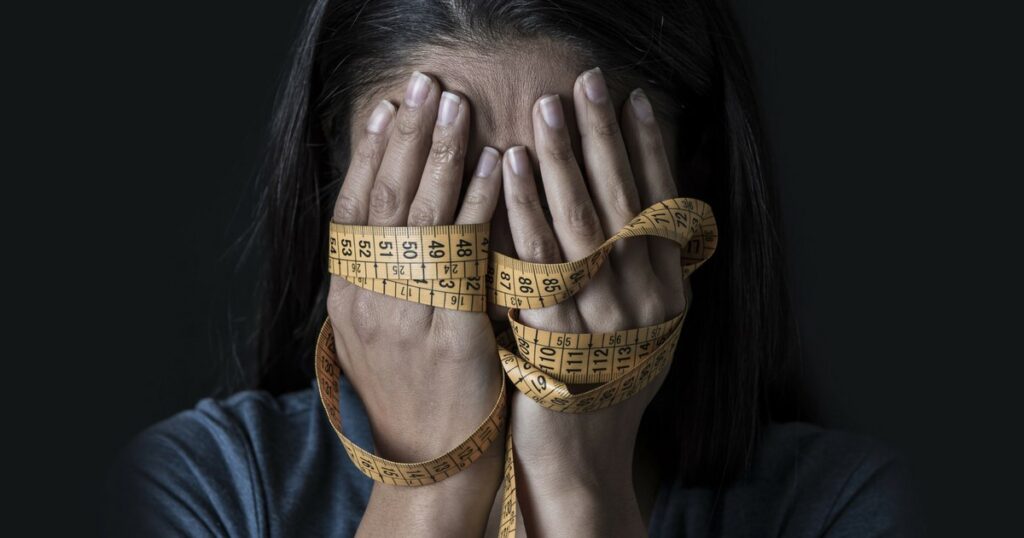 anorexia bulimia