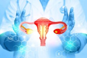 cancer de endometrio